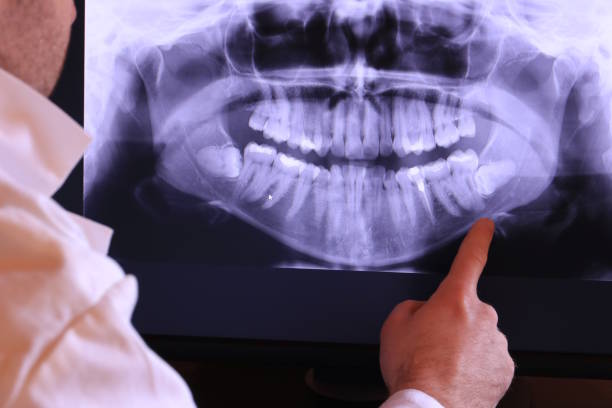 Best Emergency Treatment for Dental Infections or Abscesses in Marshall, MN